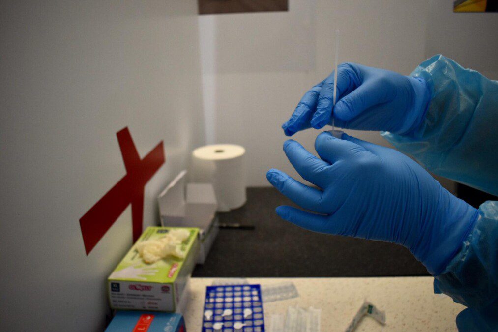Covid-19, test necessari per viaggiare: le differenze tra rapidi e PCR