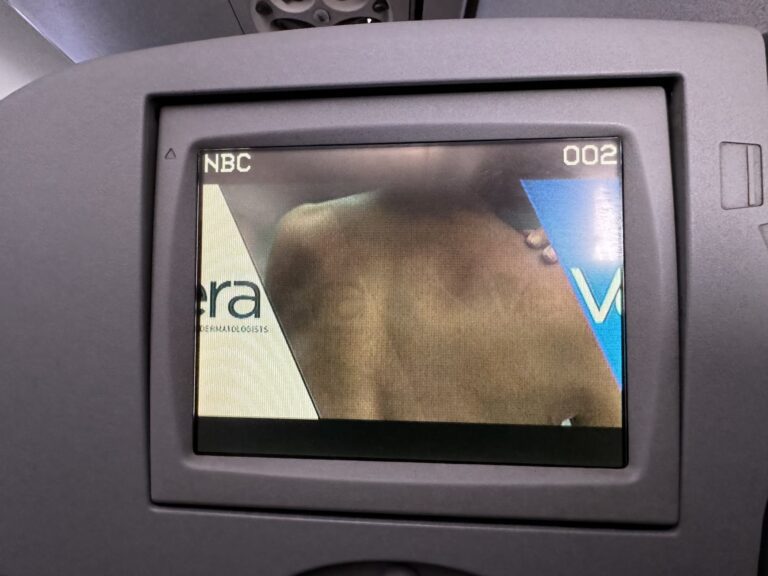 ord_jetblue_e1908136